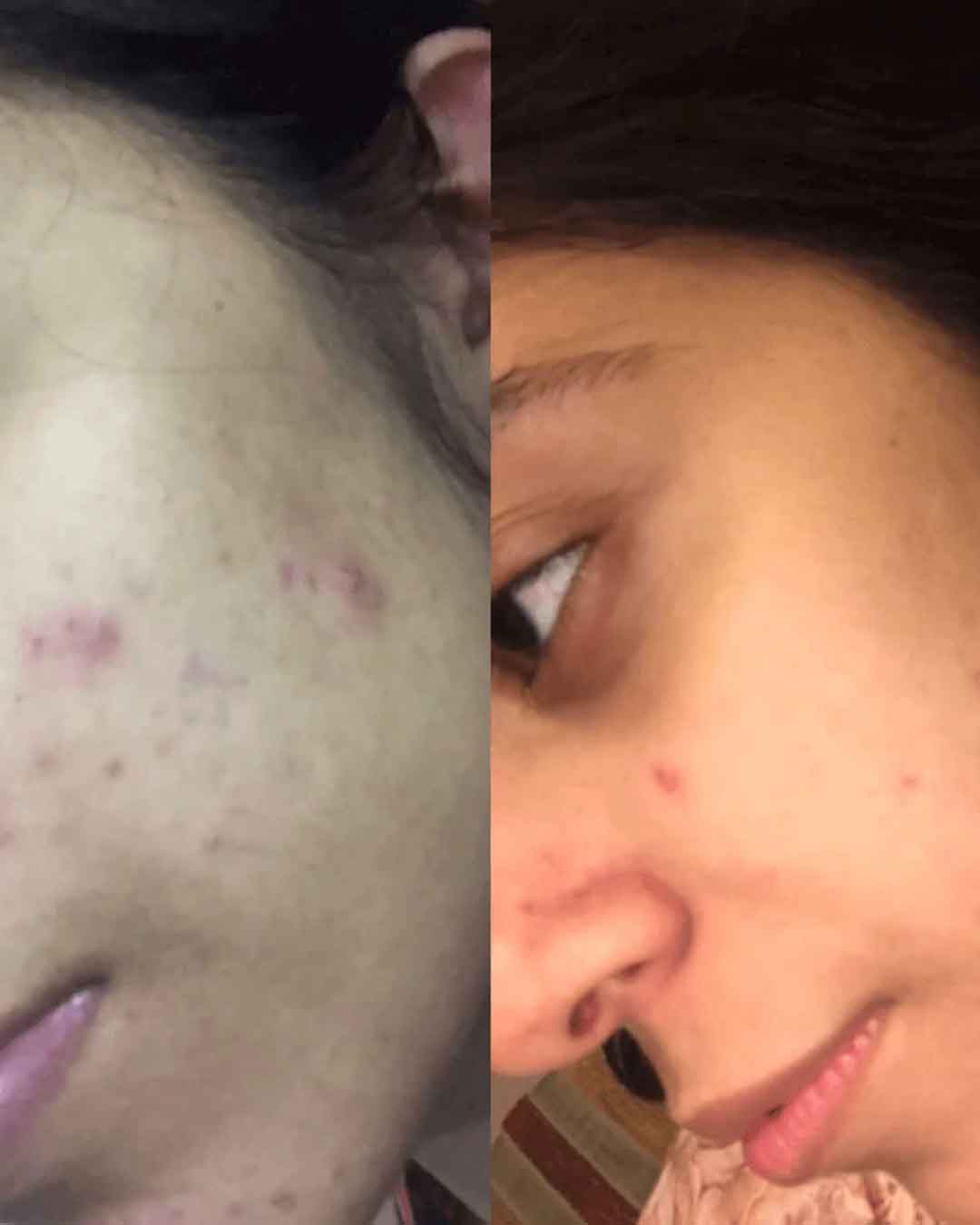Vitamin C & E Serum