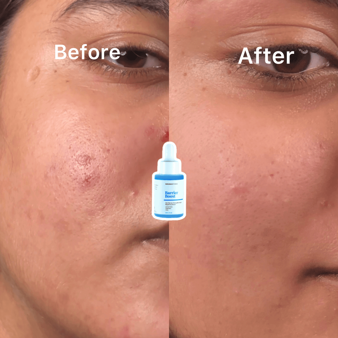 Vitamin C & E Serum
